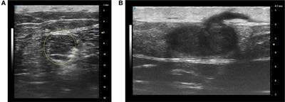 Ultrasound and Infrared-Based Imaging Modalities for Diagnosis and Management of Cutaneous Diseases